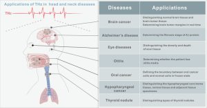 Zastosowanie w przykładowych chorobach głowy i szyi