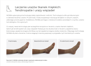 INDIBA TERAPIA TKANEK MIĘKKICH